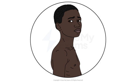 Illustrated head-and-shoulders portrait of Nwoye from Things Fall Apart, a young man with close-cropped hair and a troubled expression.