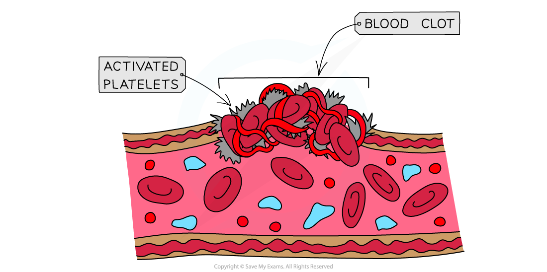 Clotting factors and blood clot formation 3