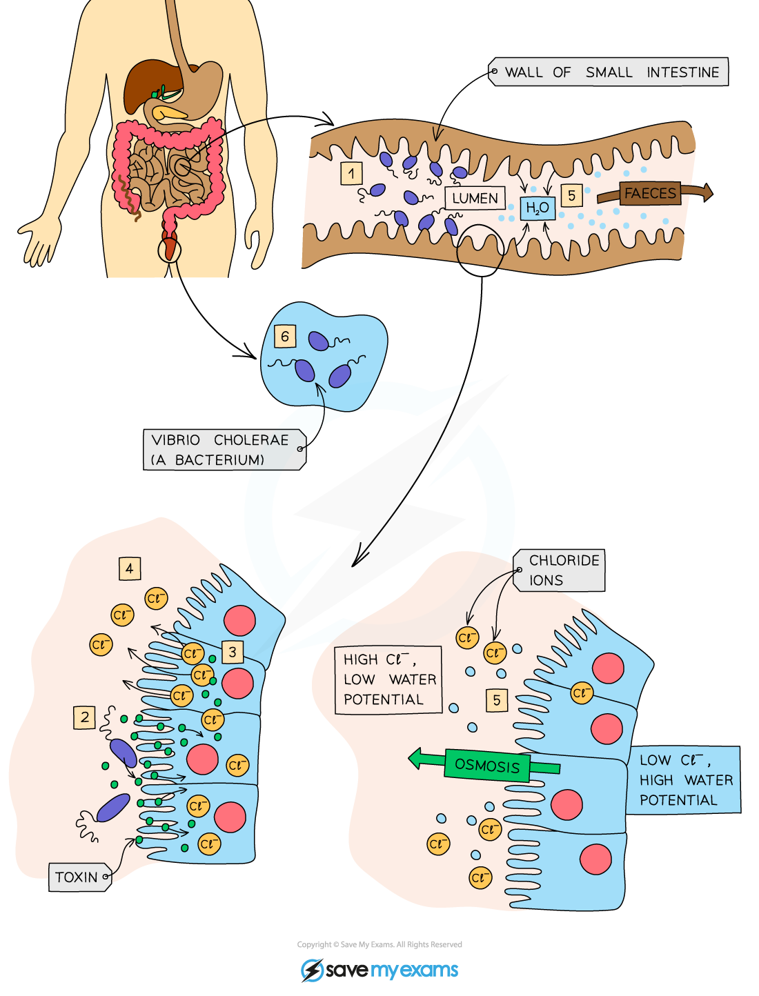 How cholera leads to diarrhoea