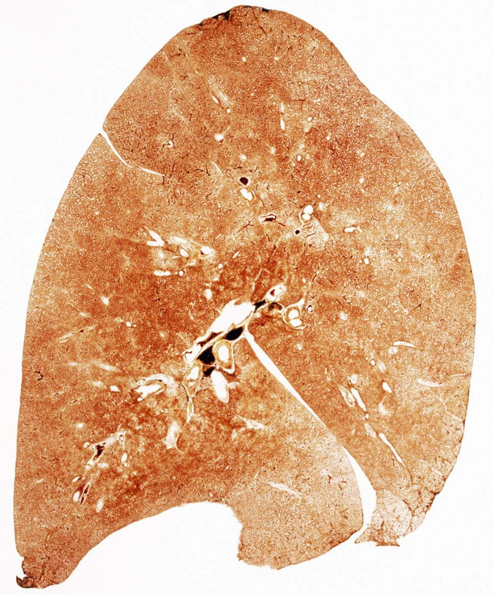 Normal lung cross section