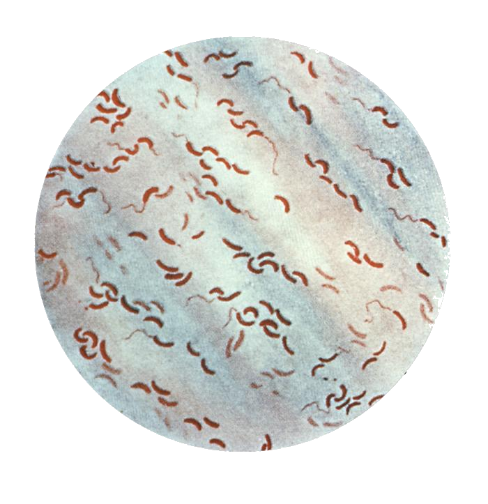 vibrio cholerae viewed under the microscope